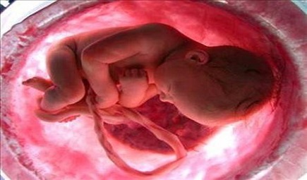 بررسی موضوع «سقط غیرقانونی جنین» در کمیسیون اصل ۹۰ مجلس